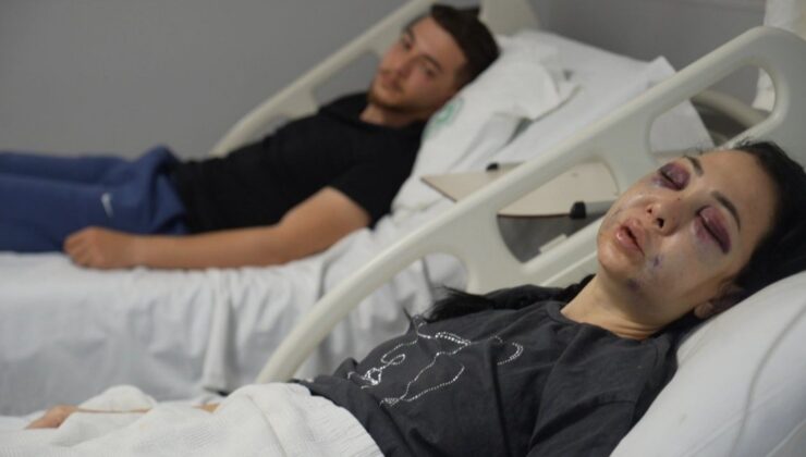 İZMİT’TE ANNE VE OĞLUNA SOKAK ORTASINDA VAHŞET: SALDIRGANLARDAN BİRİ DEMİR PARMAKLIKLAR ARDINDA!